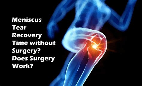 Torn Meniscus Healing Time: A Comprehensive Recovery Guide
