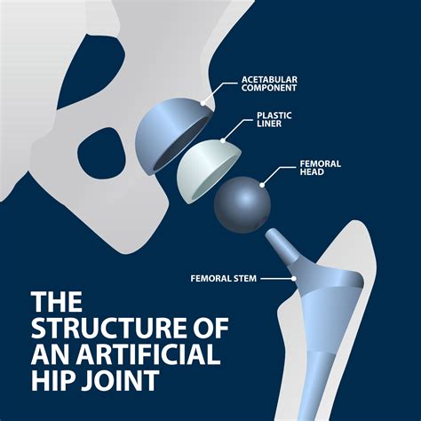 total hip surgery protocol