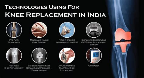 Total Knee Replacement Surgery Orthobullets