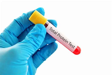 What Does a Total Protein Blood Test Reveal About Your Health?