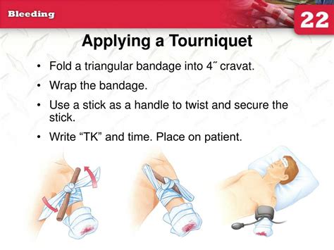 Tourniquet Powerpoint