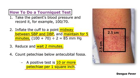 Tourniquet Test Duration