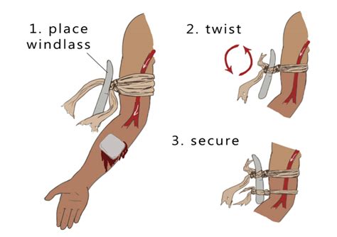 Tourniquet Training Uk