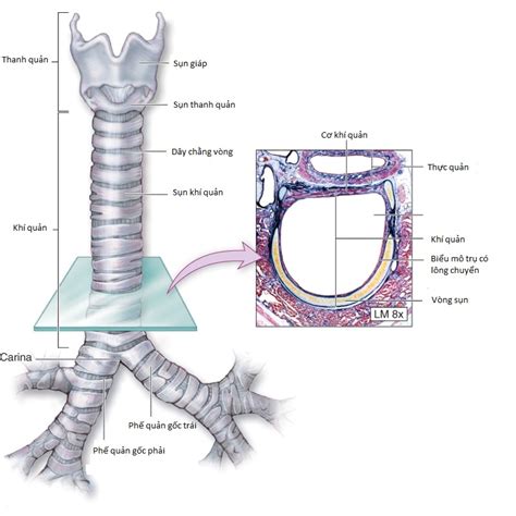 trám mở khí quản