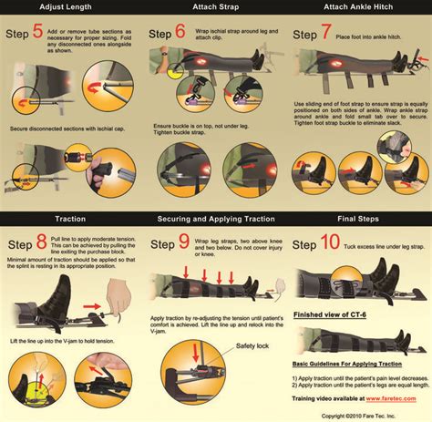 Traction Splint Steps