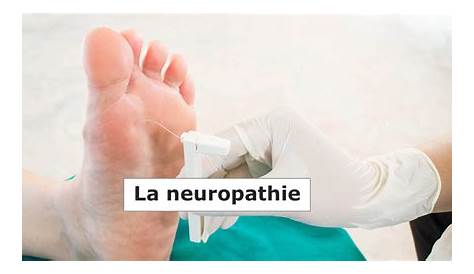 Neuropathie: Neuropathie Traitement Naturel