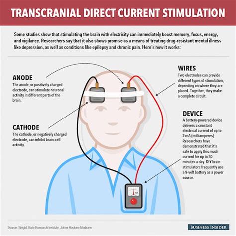 transcranial direct current stimulation adhd