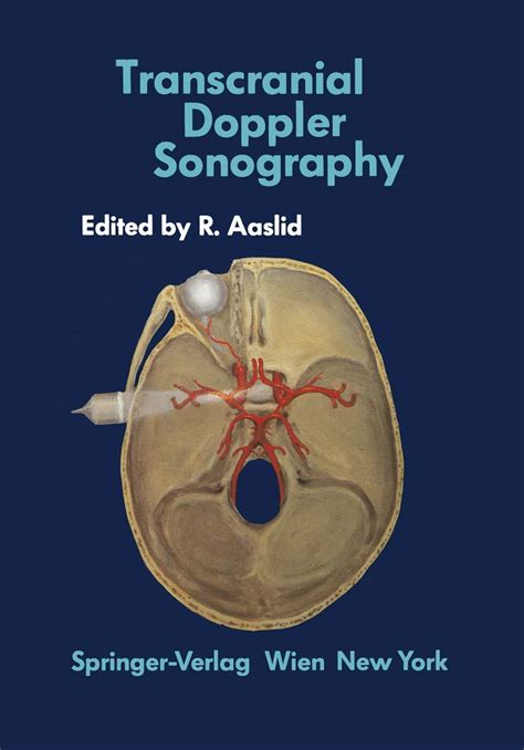 transcranial doppler sonography