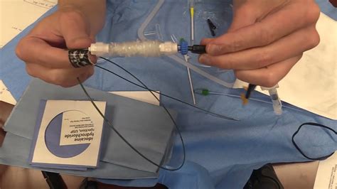 transvenous pacemaker set up
