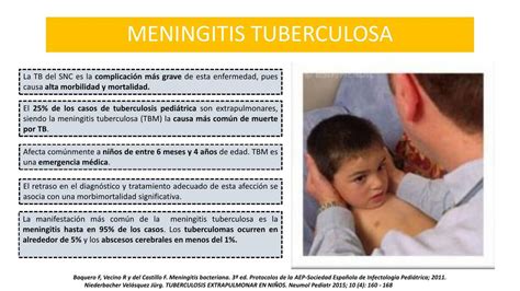 tratamiento de la meningitis tuberculosa
