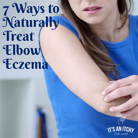 Treating Eczema Elbows