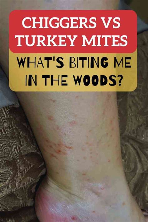 treating turkey mites