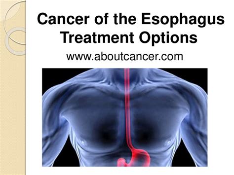 treatment cancer of the esophagus