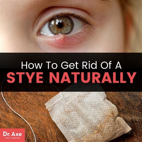 treatment for a stye on lower eyelid