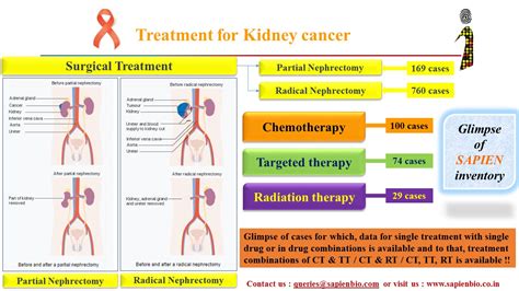 treatment for kidney cancer