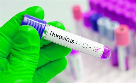 treatment for norovirus infection
