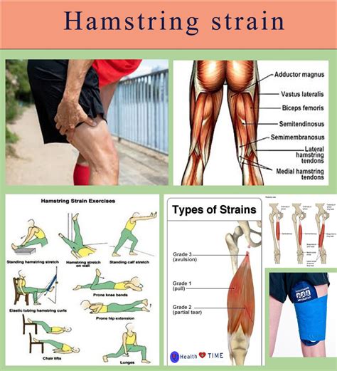 Effective Treatment for Pulled Hamstring: Speed Up Recovery and Get Back in Action