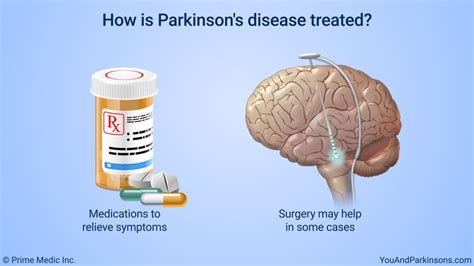 treatment of parkinson's disease