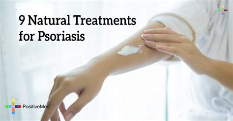 treatment psoriasis skin condition