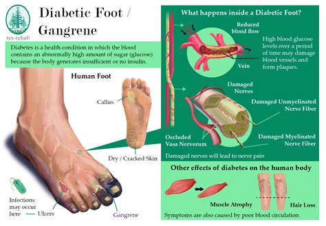 trench foot icd 10