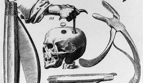 Trepanation Dark Web Real Skull Of Human Stock Image. Image Of Tooth