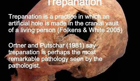 Trepanation Definition A Hole In The Head A History Of The MIT