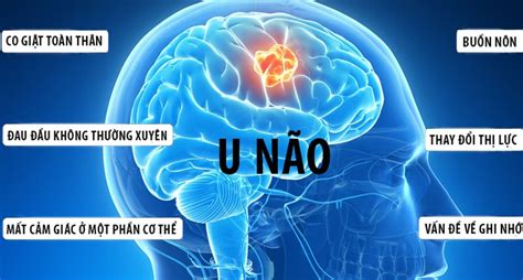 triệu chứng u não