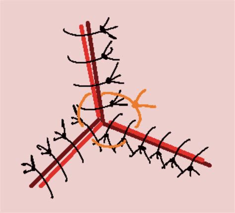 triangular wound stitch