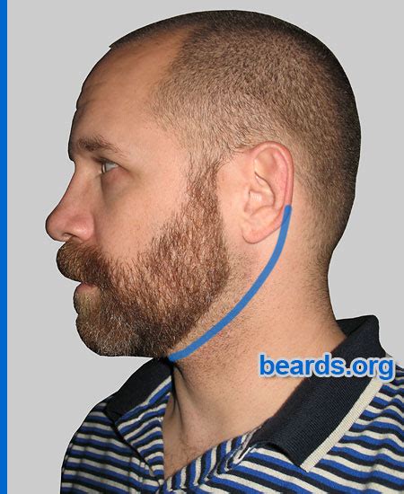 Trim Beard Under Ear
