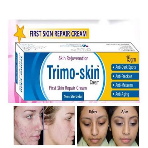 trimo skin cream price in pakistan