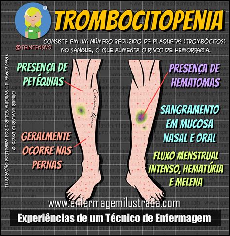trombosis con trombocitopenia