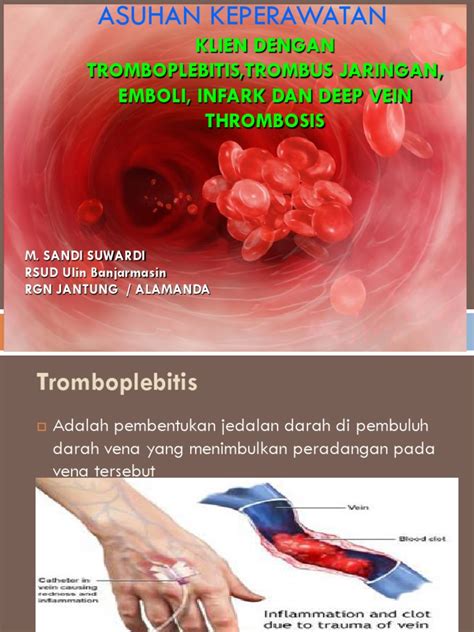 trombosis vena dalam pdf