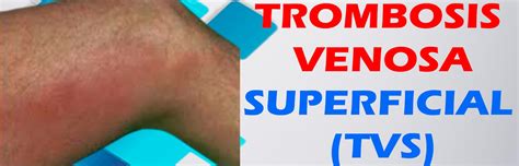 trombosis venosa superficial tratamiento pdf