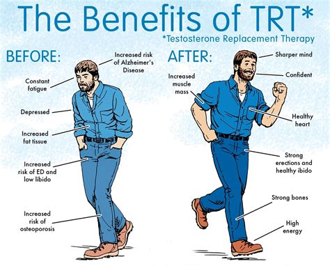 trt without working out