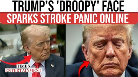 trump stroke