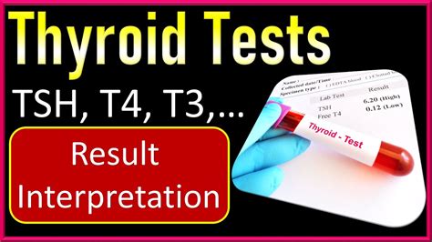 tsh blood test procedure code