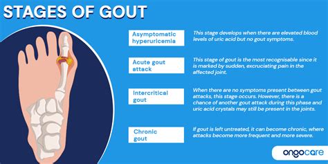 Understanding TTT of Gout: Effective Treatment and Management Options