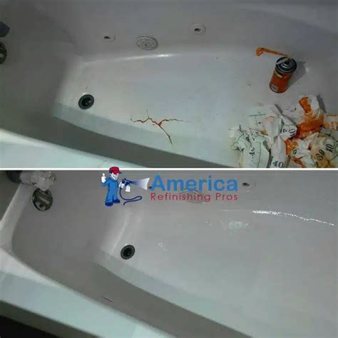 tub replacement near me