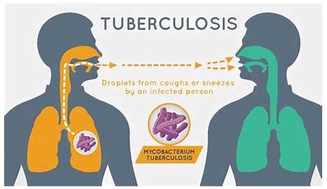 Tuberculosis Causes Vector Medical Poster Symptoms