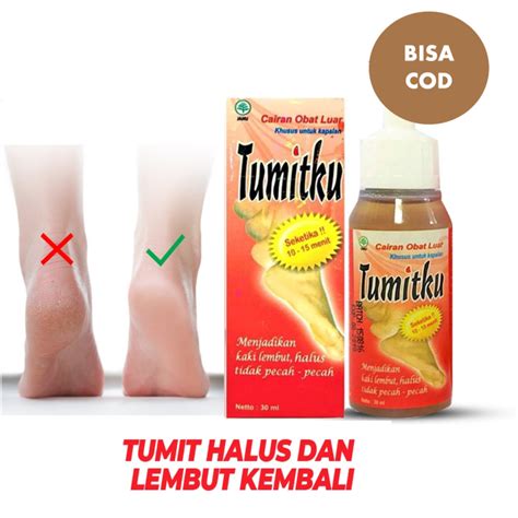 Tumit Halus dan Lembut
