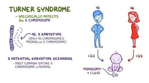 Turner's Syndrome Pattern Of Inheritance
