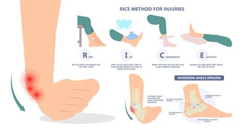Twisted Ankle Relief: Can Rice Really Help Heal Faster?