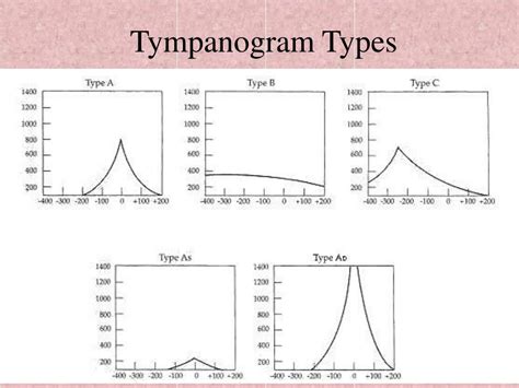 Tympanogram Examples