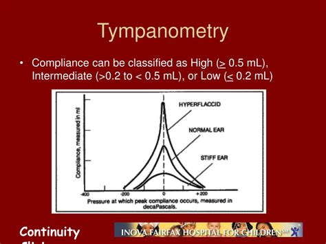 Tympanogram High Compliance