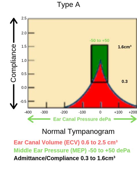 Tympanometry Interpretation
