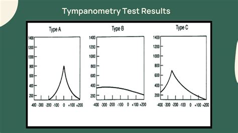 Tympanometry Results Type B