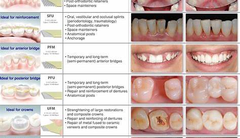 Types Of Composite Materials Dental Filling Material/anterior Light Cure
