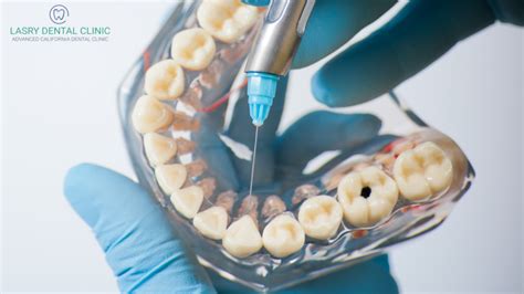 Types Of Anesthesia In Dentistry