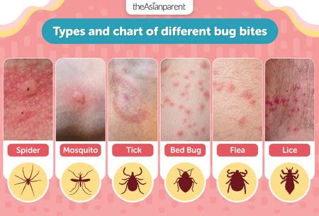 Types Of Bites Pictures