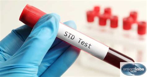 Types Of Blood Tests For Std